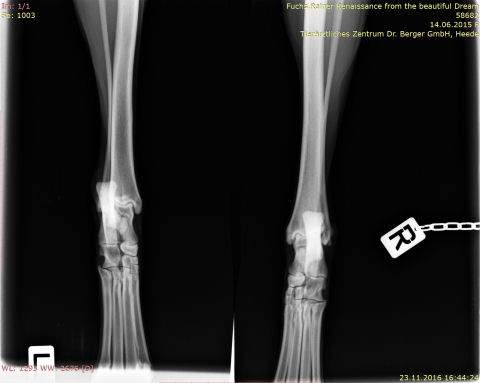 IMG-0005-00001-sprunggelenk