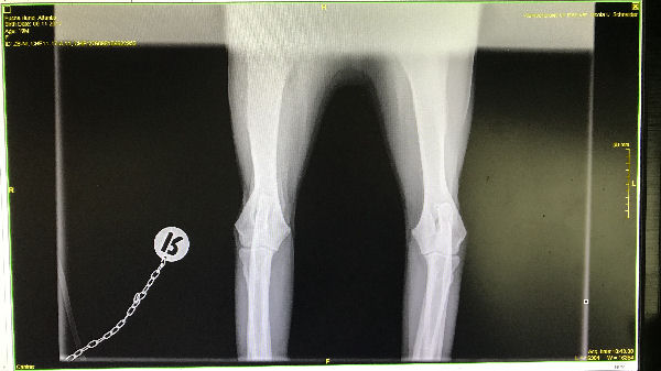 img_5245-Atlantis-ocd